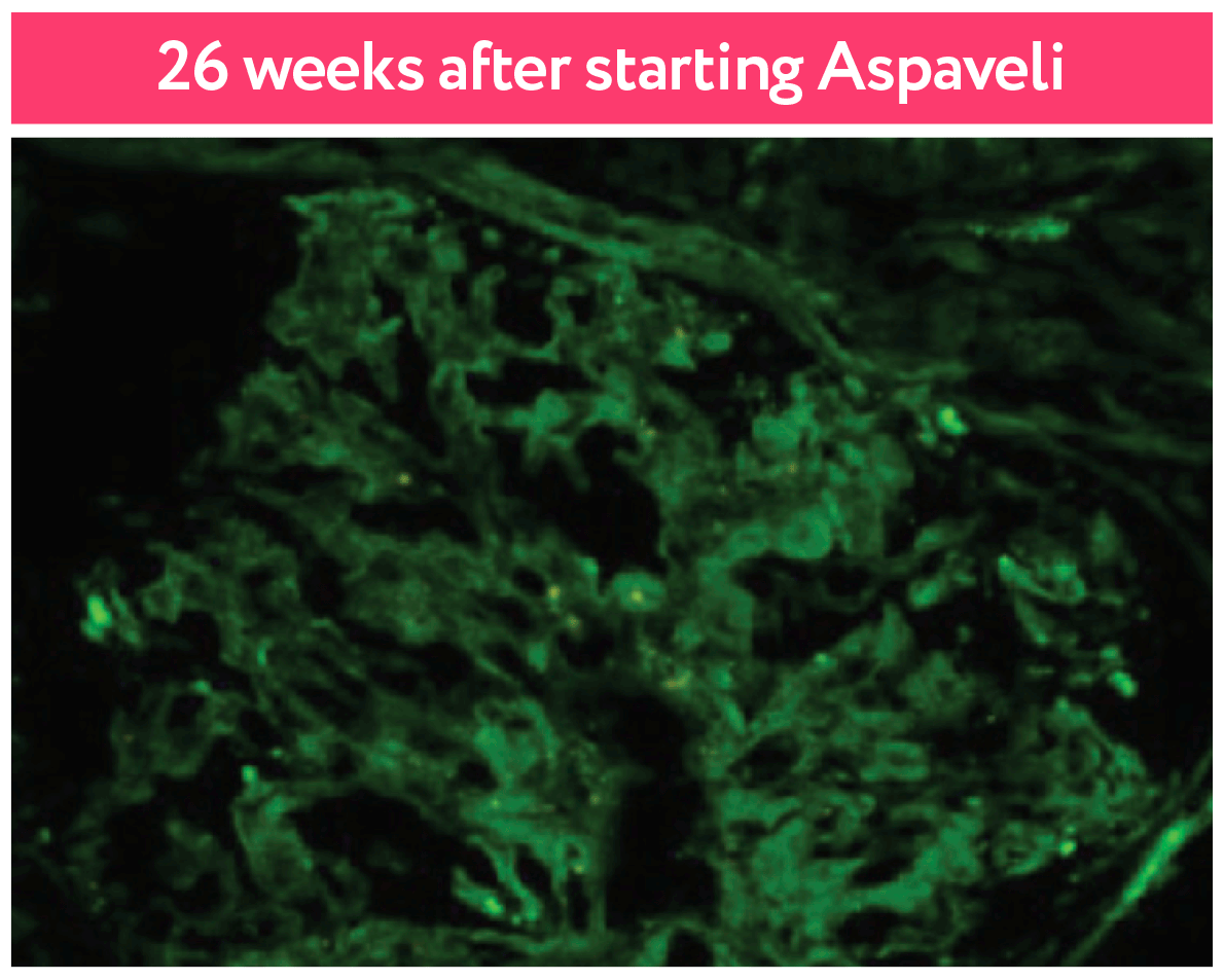 26 weeks after starting Aspaveli