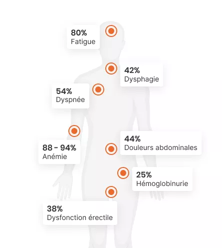 Symptômes