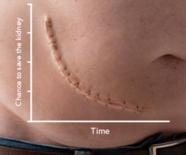 Renal scar