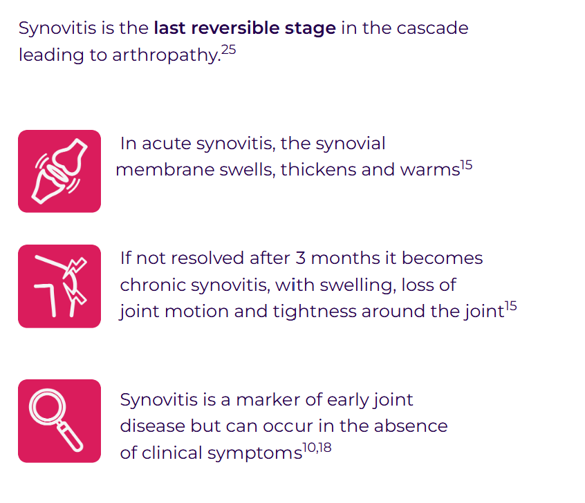 Synovitis image