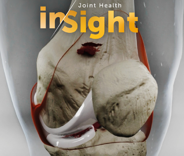 insight