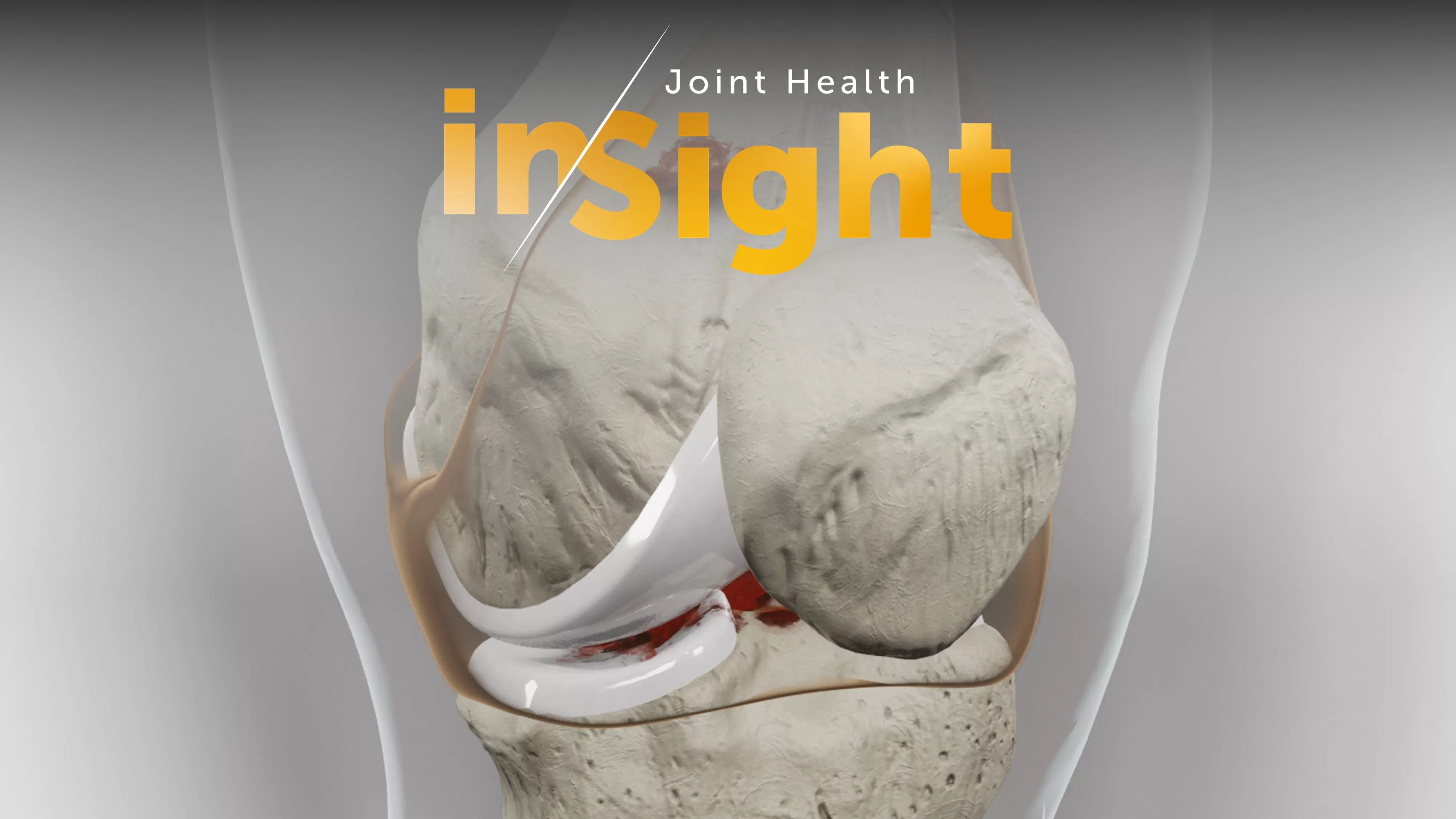 Joint Health InSight Tool