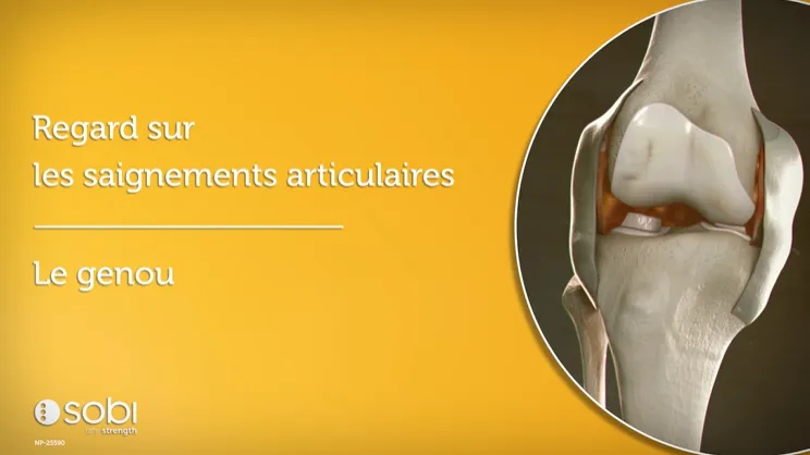 Les saignements articulaires