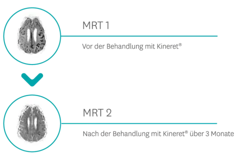 MRT