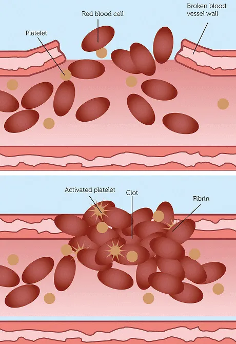 Platelet bleed diagram